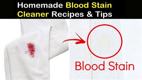 removing old blood from fabric